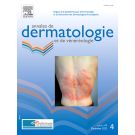 ANNALES DE DERMATOLOGIE ET DE VENEREOLOGIE